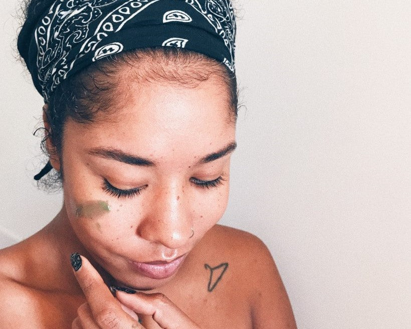 why are some people more prone to acne?